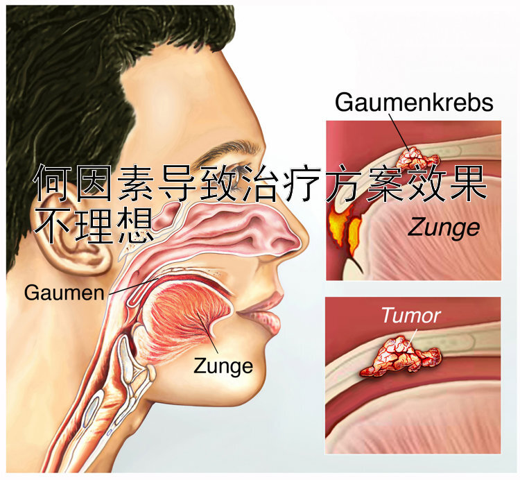 何因素导致治疗方案效果不理想</